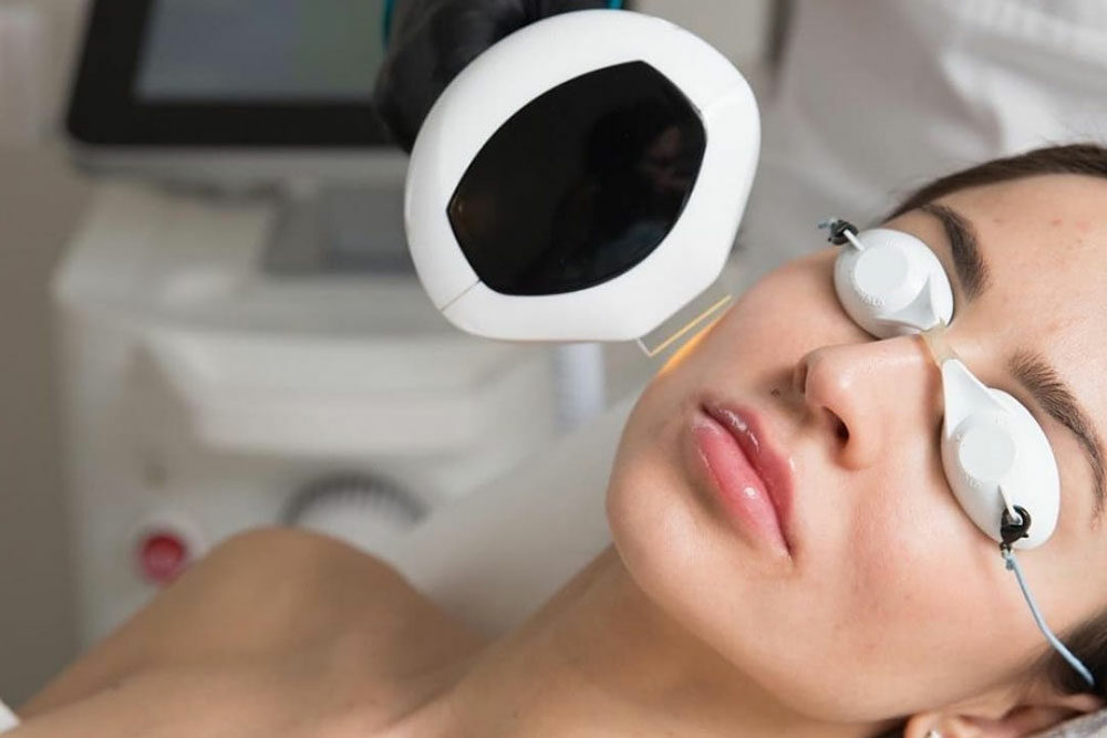 Ästhetische Medizin Frechen / Königsdorf - IPL-Lasertherapie